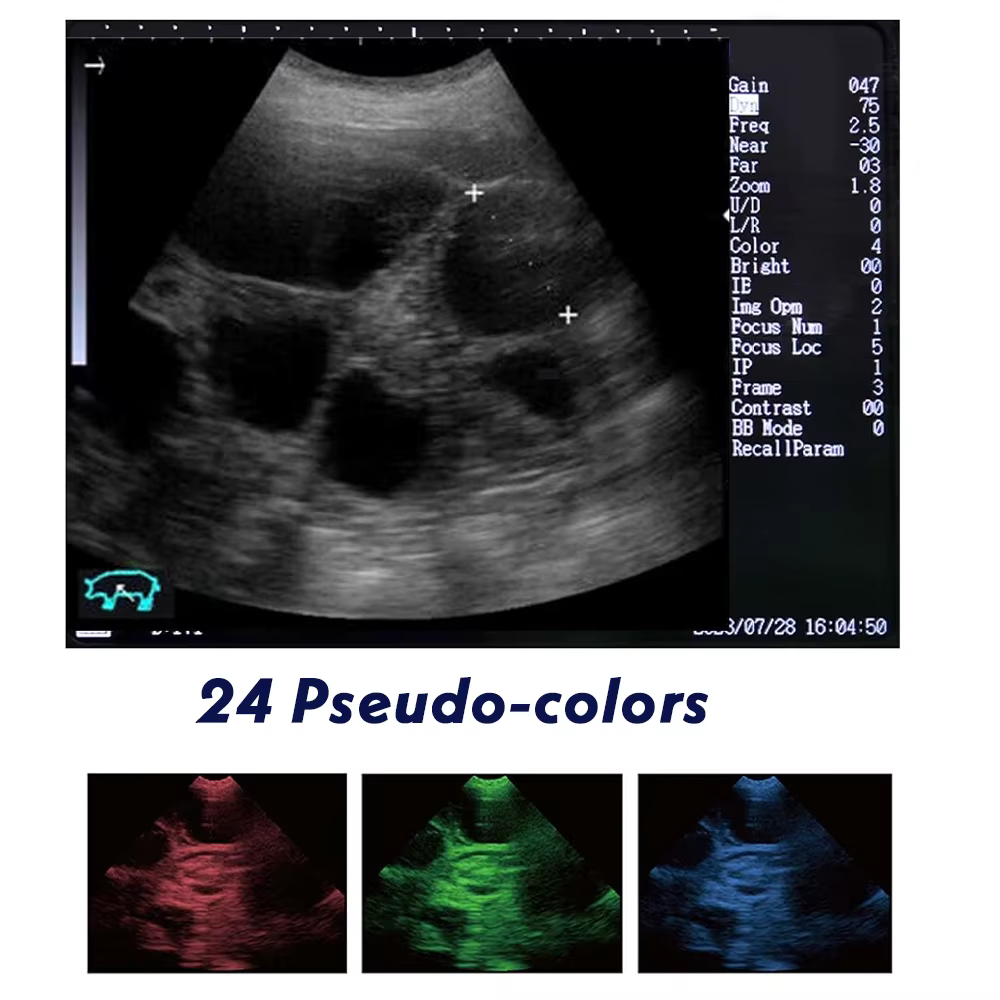 SINOHERO 3.5/5/6.5Hz Ecógrafo Portátil Veterinario B-Ultra para Diagnóstico Animal de Gestación — imagen 5