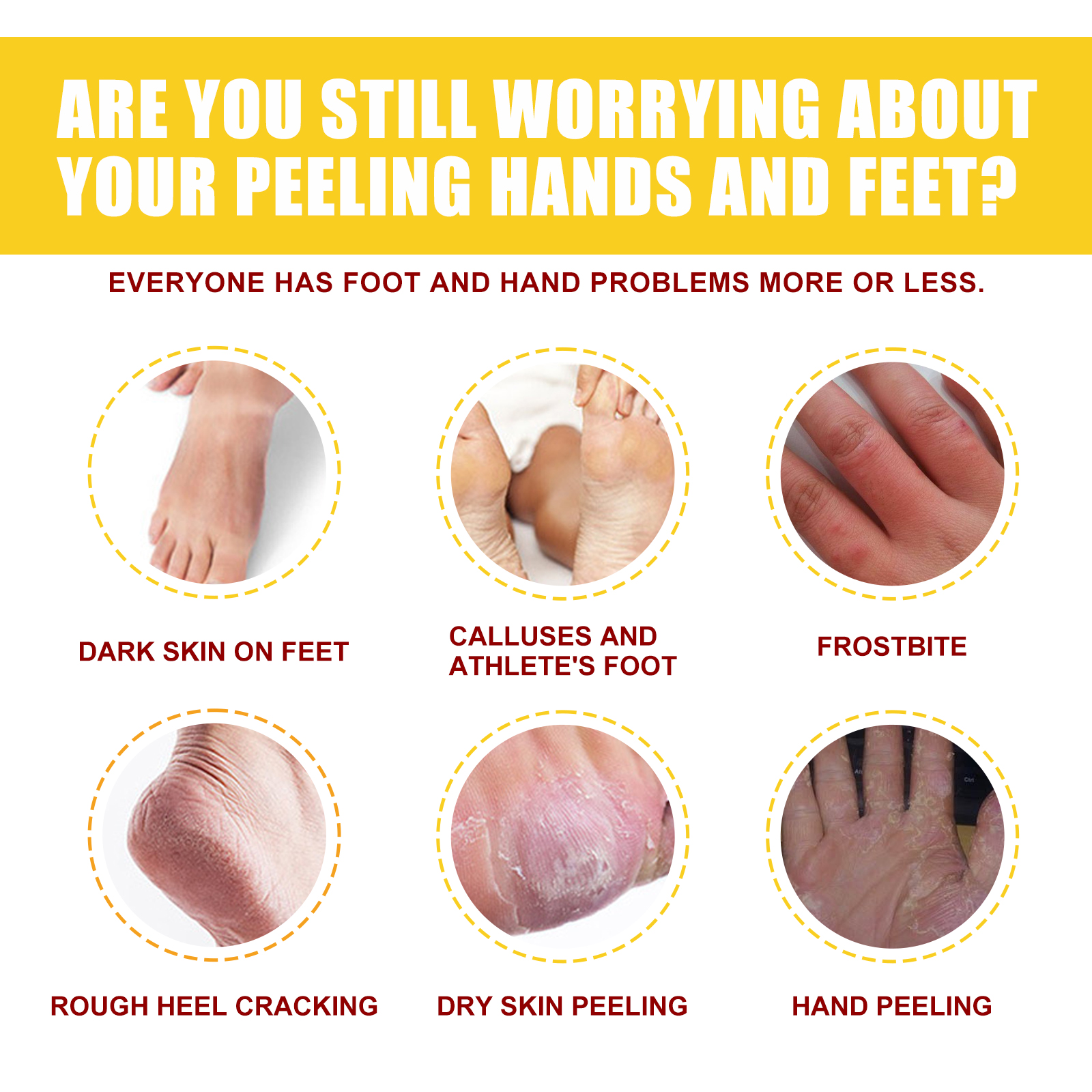 EELHOE Horse Oil Hand And Foot Repair Cream, Chapped Skin Care Moisturizing And Anti-Peeling Repair Cream — image 4