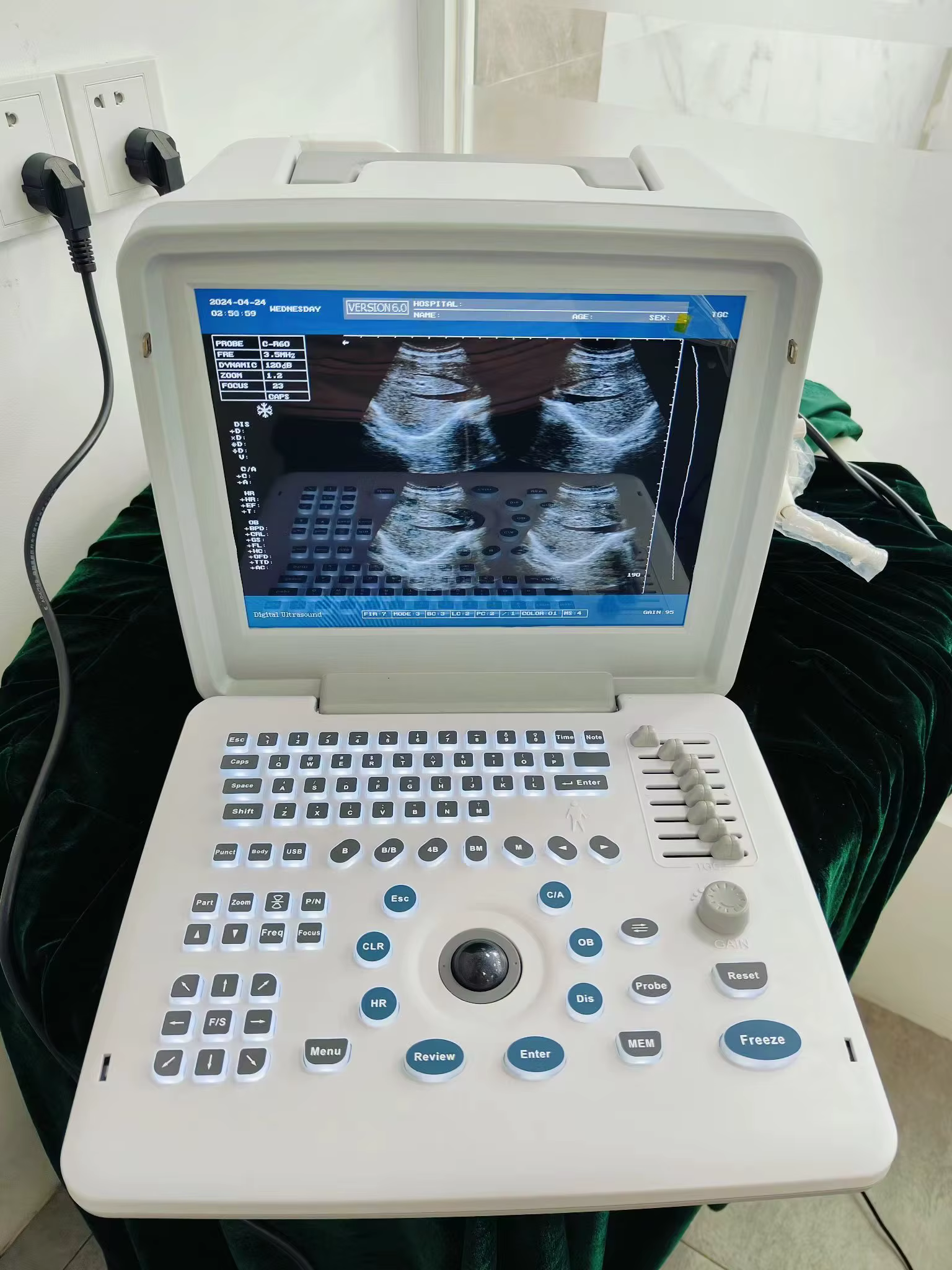 Rayman Ultrasound Portátil para Veterinarios - Máquina de Ecografía Portátil para Animales