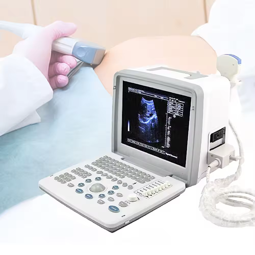 Rayman Ultrasound Portátil para Veterinarios - Máquina de Ecografía Portátil para Animales — imagen 5