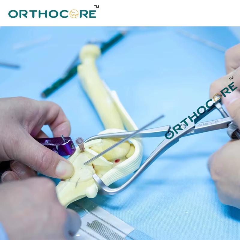 Pinzas de Reducción TPLO fabricadas por mecanizado CNC instrumentos veterinarios ortopédicos equipo ortocore veterinario — imagen 5