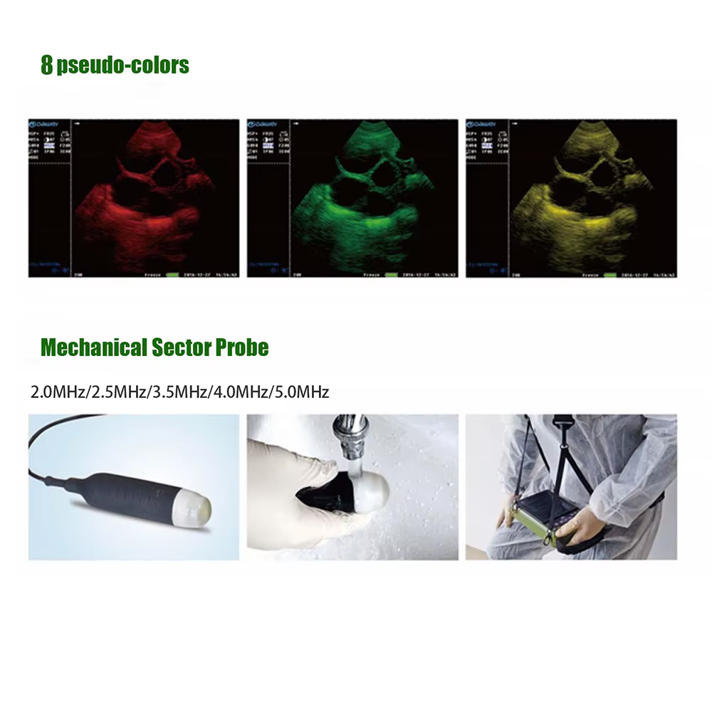 Portable Veterinary Ultrasound Scanner for Pregnancy Vet B-Ultra Machine with 3.5MHz Rectal Probe for Cows Horses Camels Animals — image 7